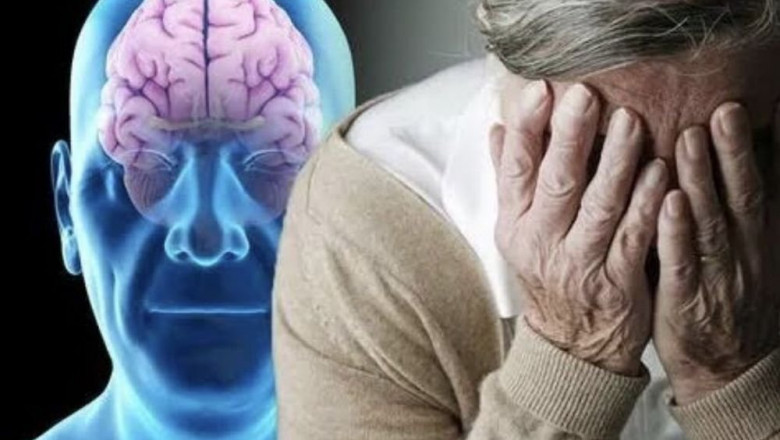Lewy Body Dementia Market Size, Trends, and Growth Outlook 2025-2032
