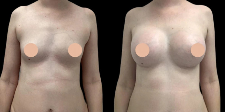 The Best Doctors in Dubai: Top Clinics & Breast Augmentation Experts | Perfect Doctor