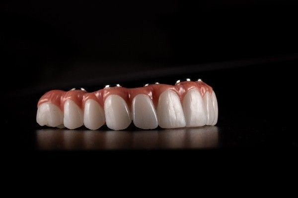  dental implants Durham