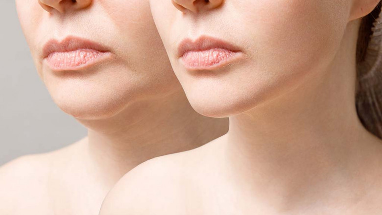 A Great Way to Look Younger