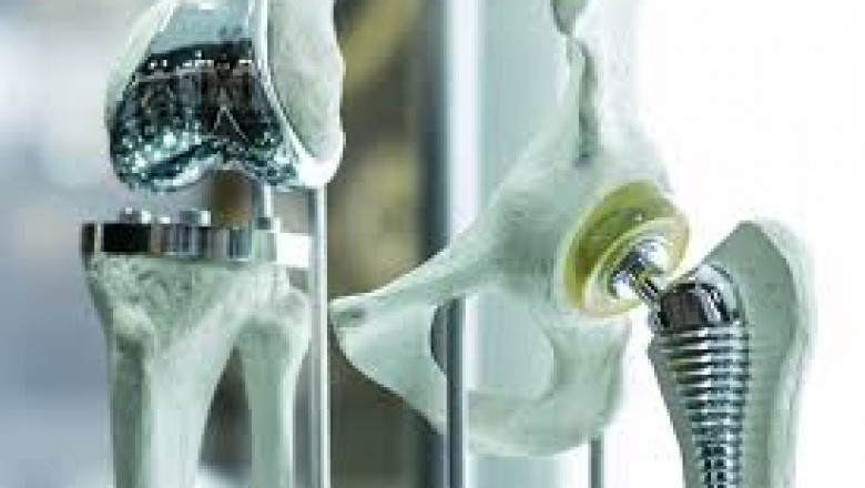 Global Medical Implant Trends 2025–2035: From Biocompatibility to Biointegration