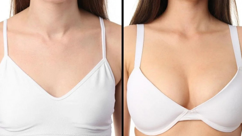 Breast Augmentation in Dubai: What to Expect Before, During, and After Surgery
