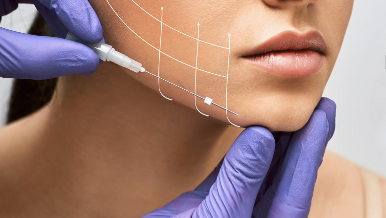Facial Thread Lift in Dubai: How Thread Lifts Can Treat the Lower Face and Jawline