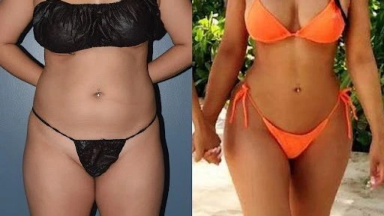Redefining Beauty Celebrating Your Liposuction Results in Dubai