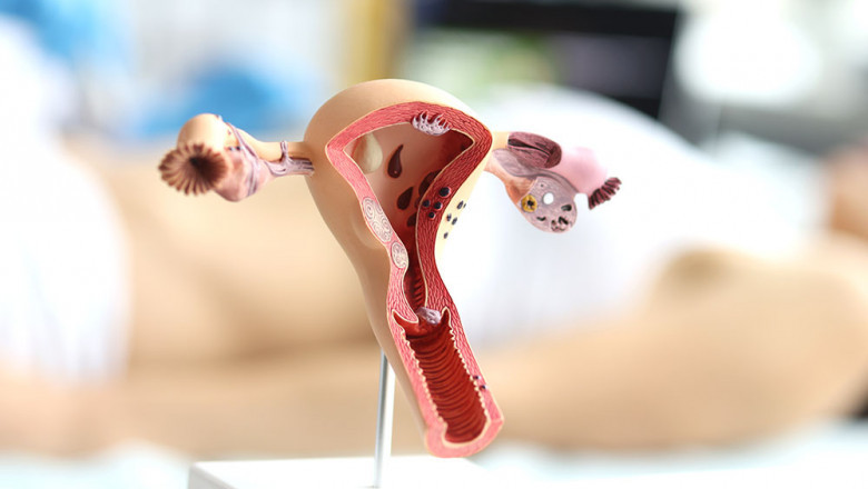 When Should You Get a Pap Smear in Dubai? Age, Frequency, and Timing Explained