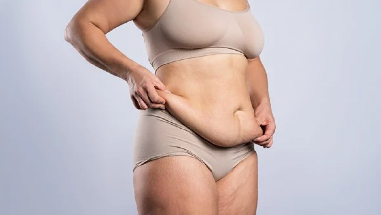 Mommy Makeover in Dubai: The Cost of Mommy Makeover Procedures and Payment Options