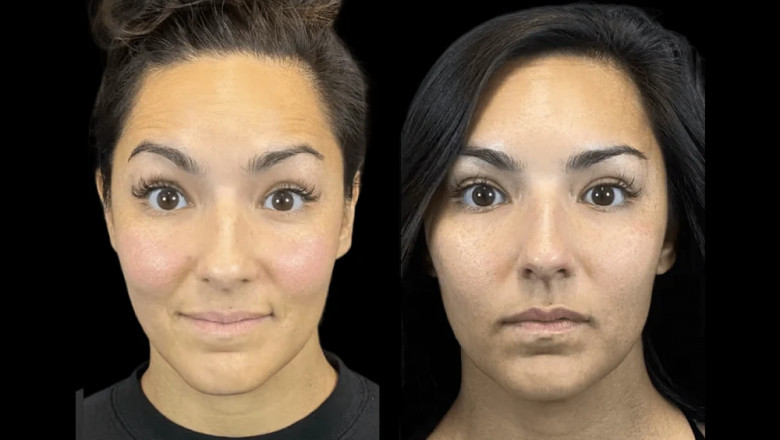 Best Aesthetic Clinic in Dubai for Anti-Aging Treatments: What You Should Know
