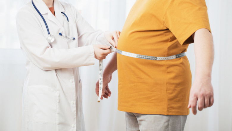 Obesity Treatment Dubai: Finding the Right Clinic and Doctor for Effective Results