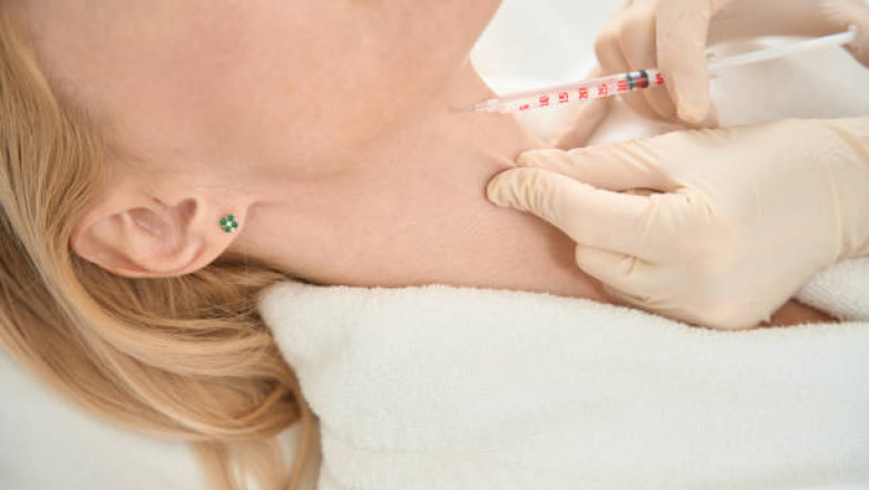 Say Goodbye to Your Double Chin: The Power of Belkyra Kybella Treatment