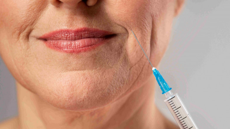 How to Choose Dermal Fillers in Mississauga