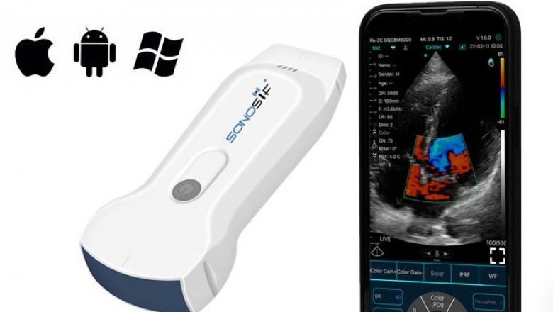 SONOSIF - Advanced Ultrasound Scanners & Medical Devices