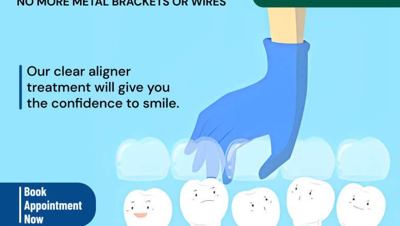 Invisalign Braces in Hoodi Bangalore: The Modern Solution for a Confident Smile