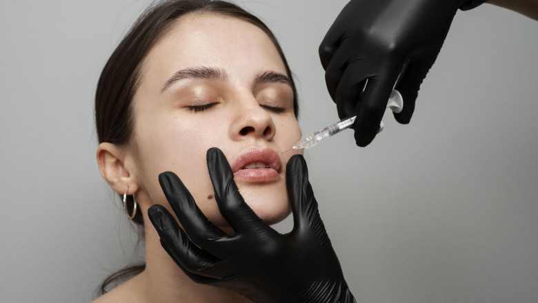 What Are the Best Dermal Fillers Available in Mississauga?