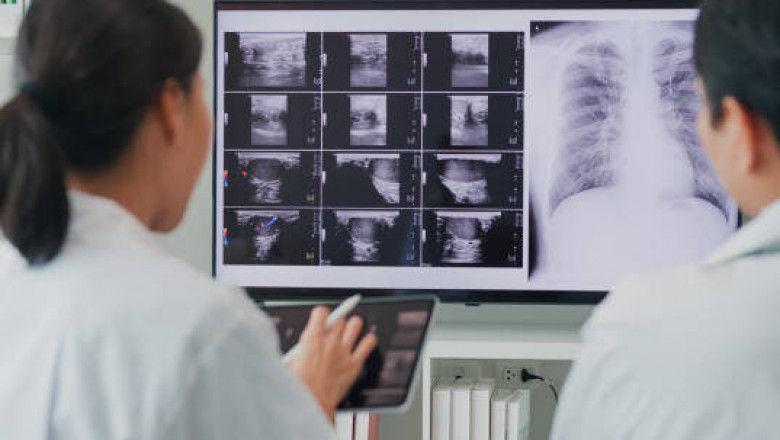 Upgrade Old X-Ray Machine with Digital Flat Panel Technology