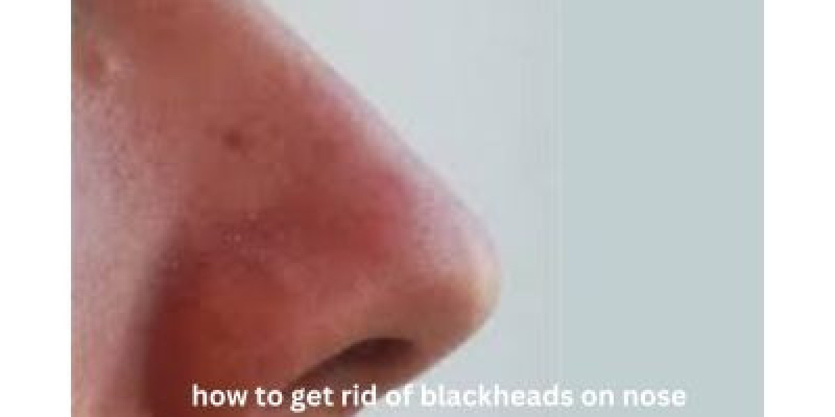 Clearing the Path: Effective Ways to Get Rid of Blackheads on Your Nose