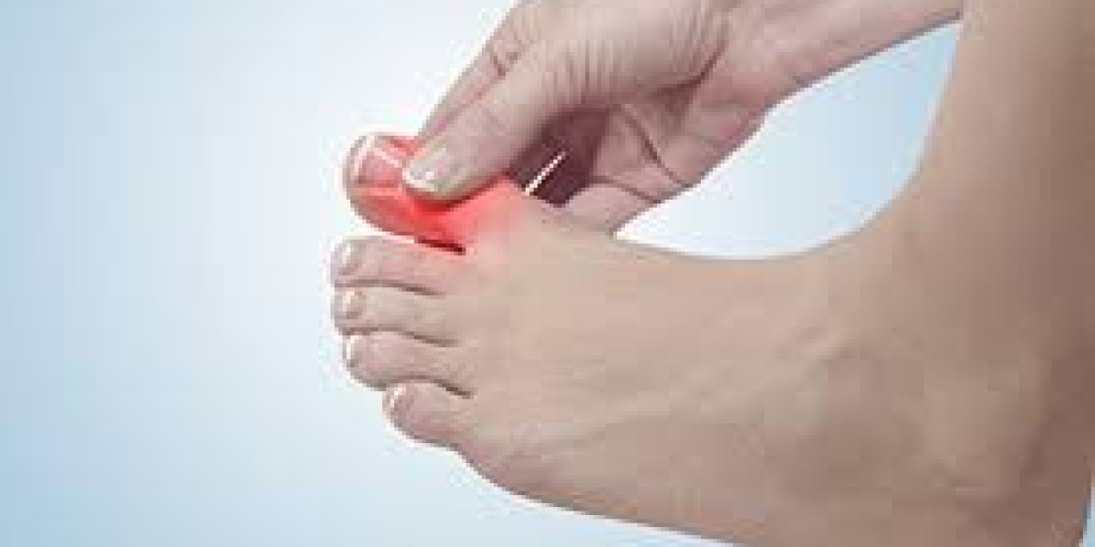 Second Toe Pain: Causes and Solutions
