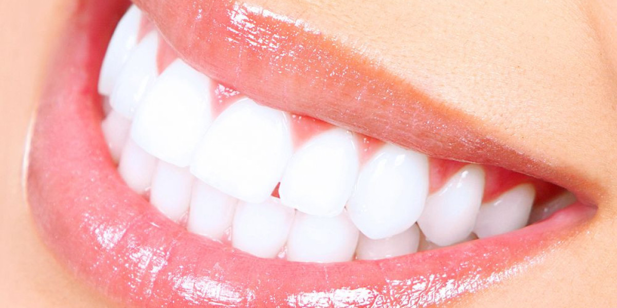 : Dubai's Celebrity Smiles: The Luxurious World of Teeth Whitening