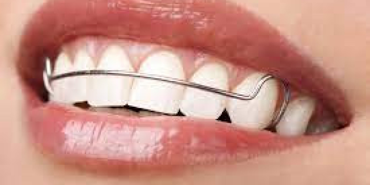 Nighttime Retainers: Addressing Orthodontic Issues While You Sleep