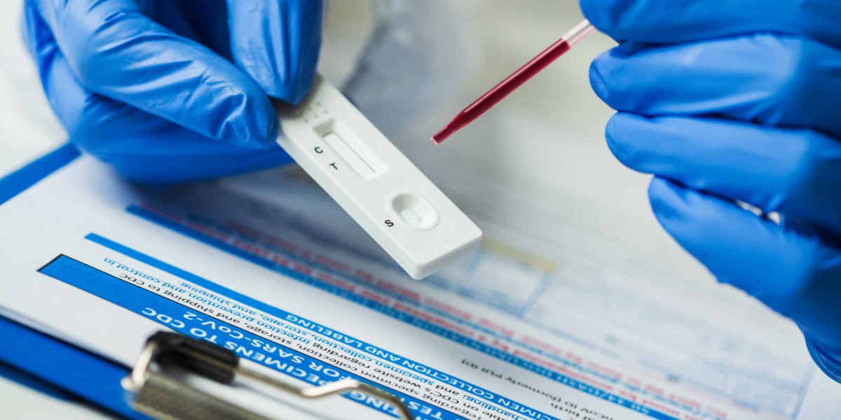 Global Rapid Drug Testing Kit Market Size/Share Worth US$ 9607 million by 2030 at a 8.90% CAGR