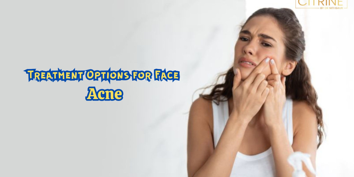 Treatment Options for Face Acne