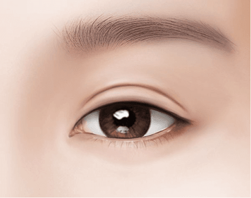 Everything You Need to Know About Blepharoplasty and Eyelid Surgery