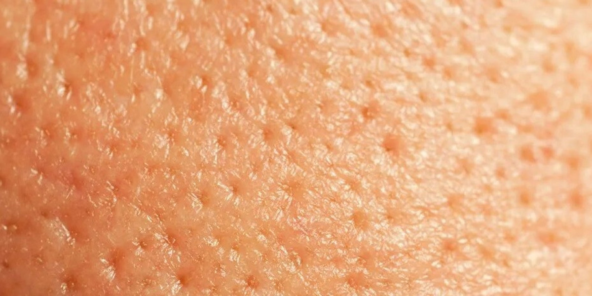 Myths About Open Pores That One Needs To Stop Believing