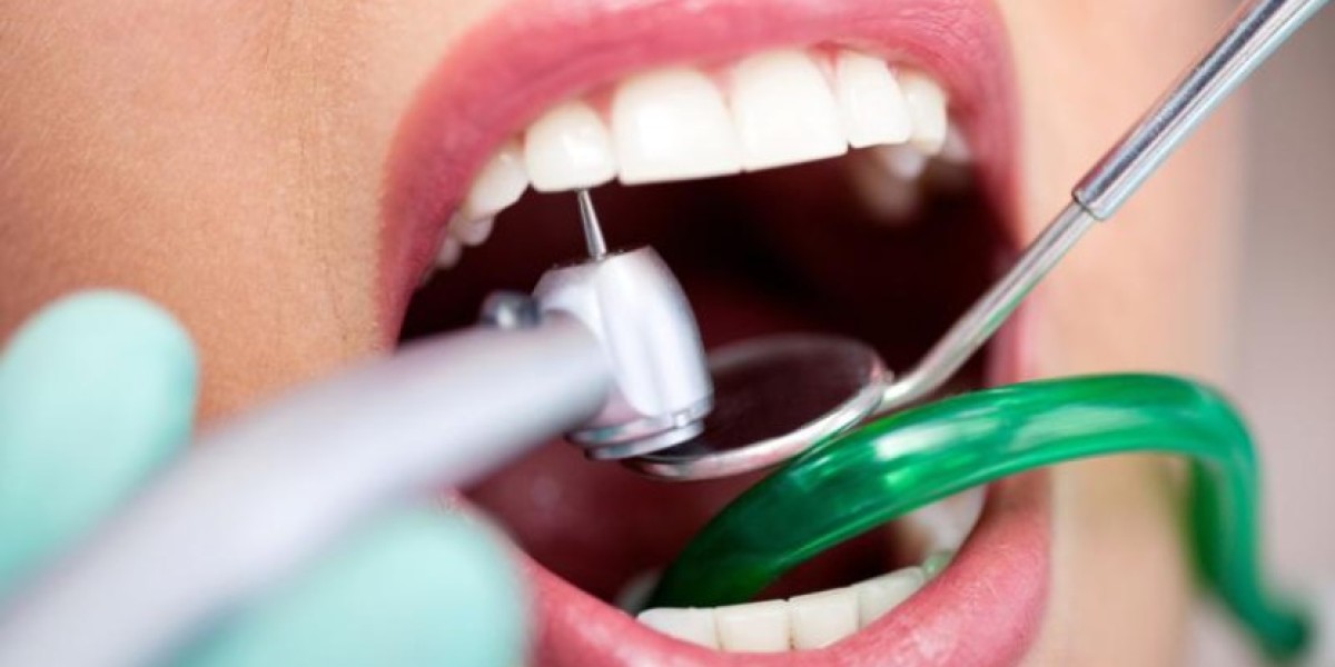 Global Dental Consumables Market, Growth, Forecast, Key Insights, Reports, Size, 2024 - 2032