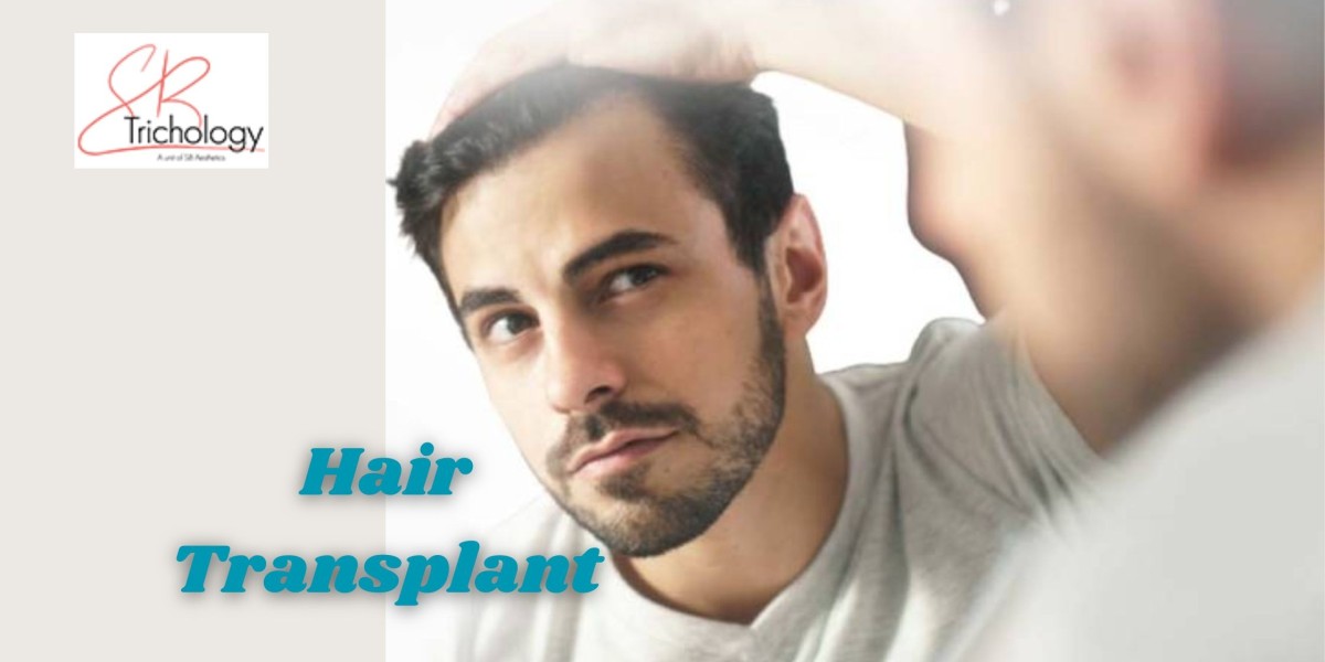 Can You Smoke Before and After a Hair Transplant?