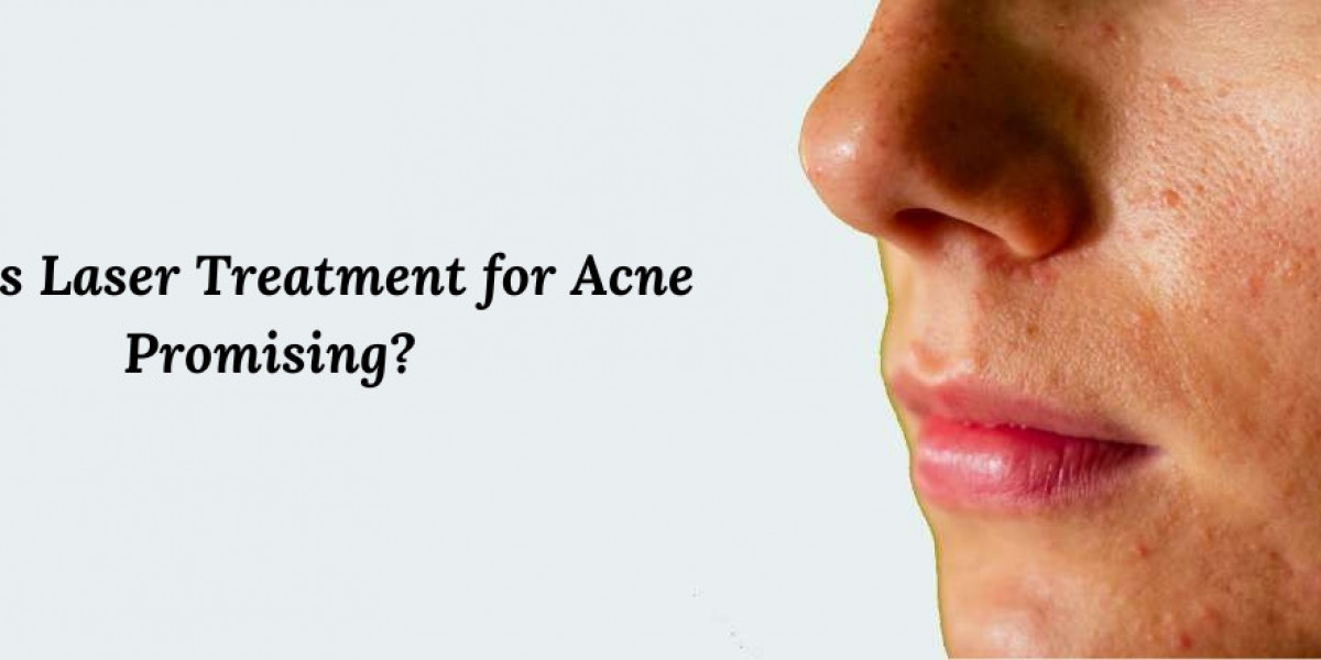 Why is Laser Treatment for Acne Promising?