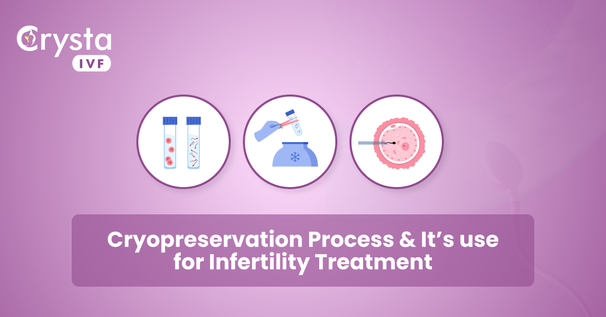 Cryopreservation Process & It’s Use For Infertility Treatment