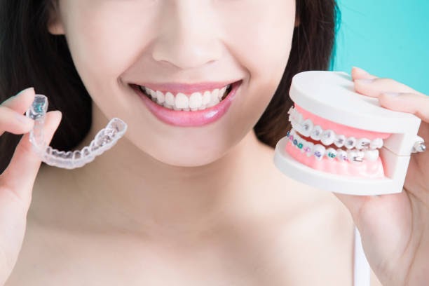 Advantages of Choosing Invisalign over Braces