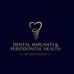 DENTAL IMPLANTS And PERIODONTAL HEALTH Profile Picture