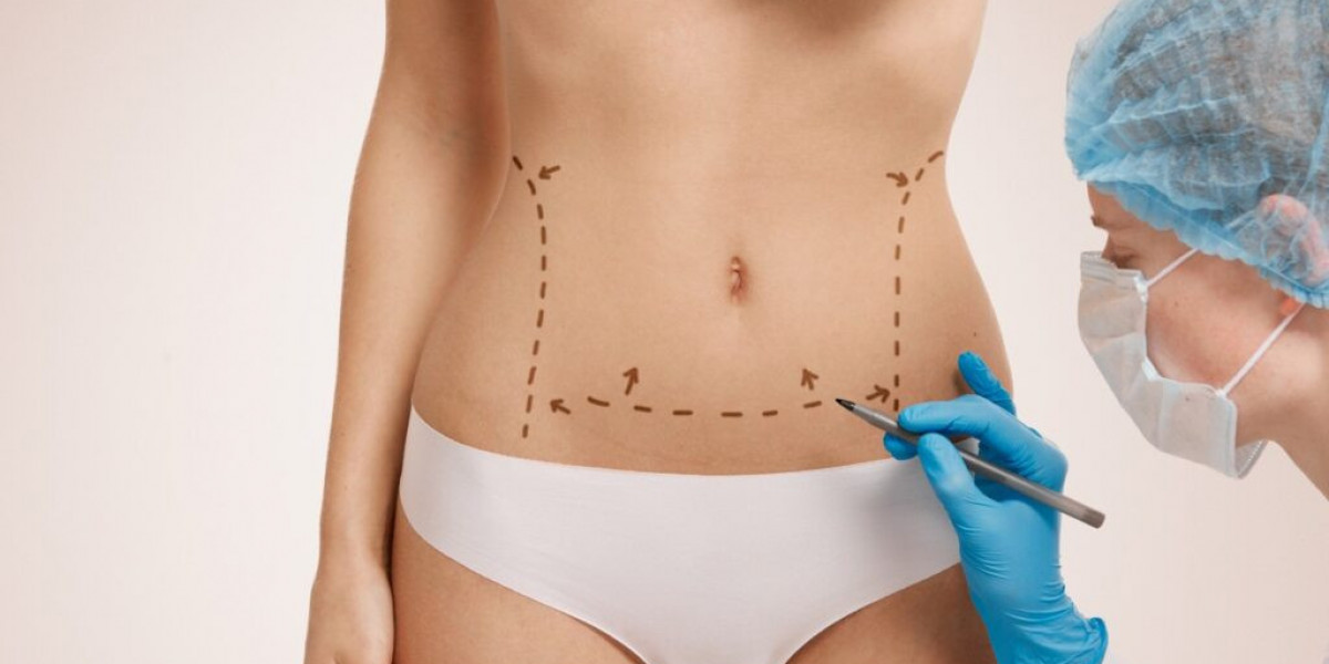 Dubai Liposuction: Redefining Body Contours