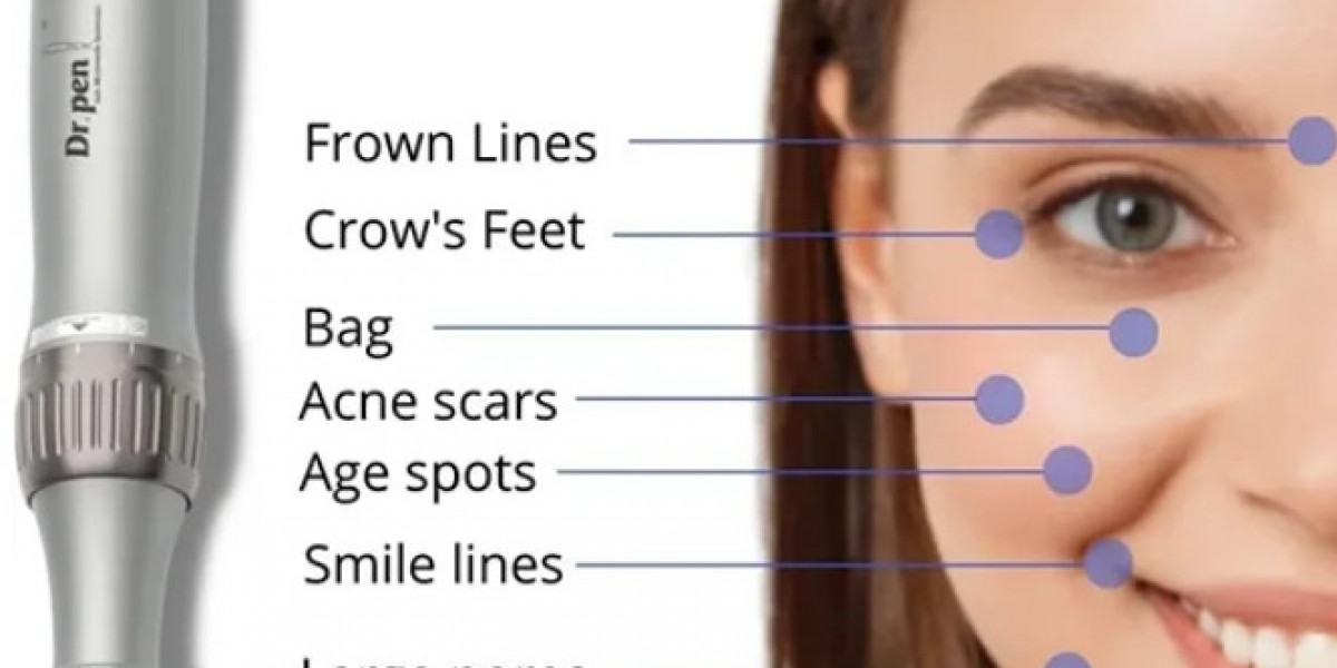 Wie Oft Microneedling Bei Falten