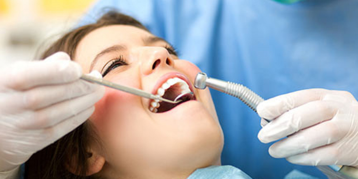 The Hidden Impact of Marietta Dental Professionals on Everyday Health