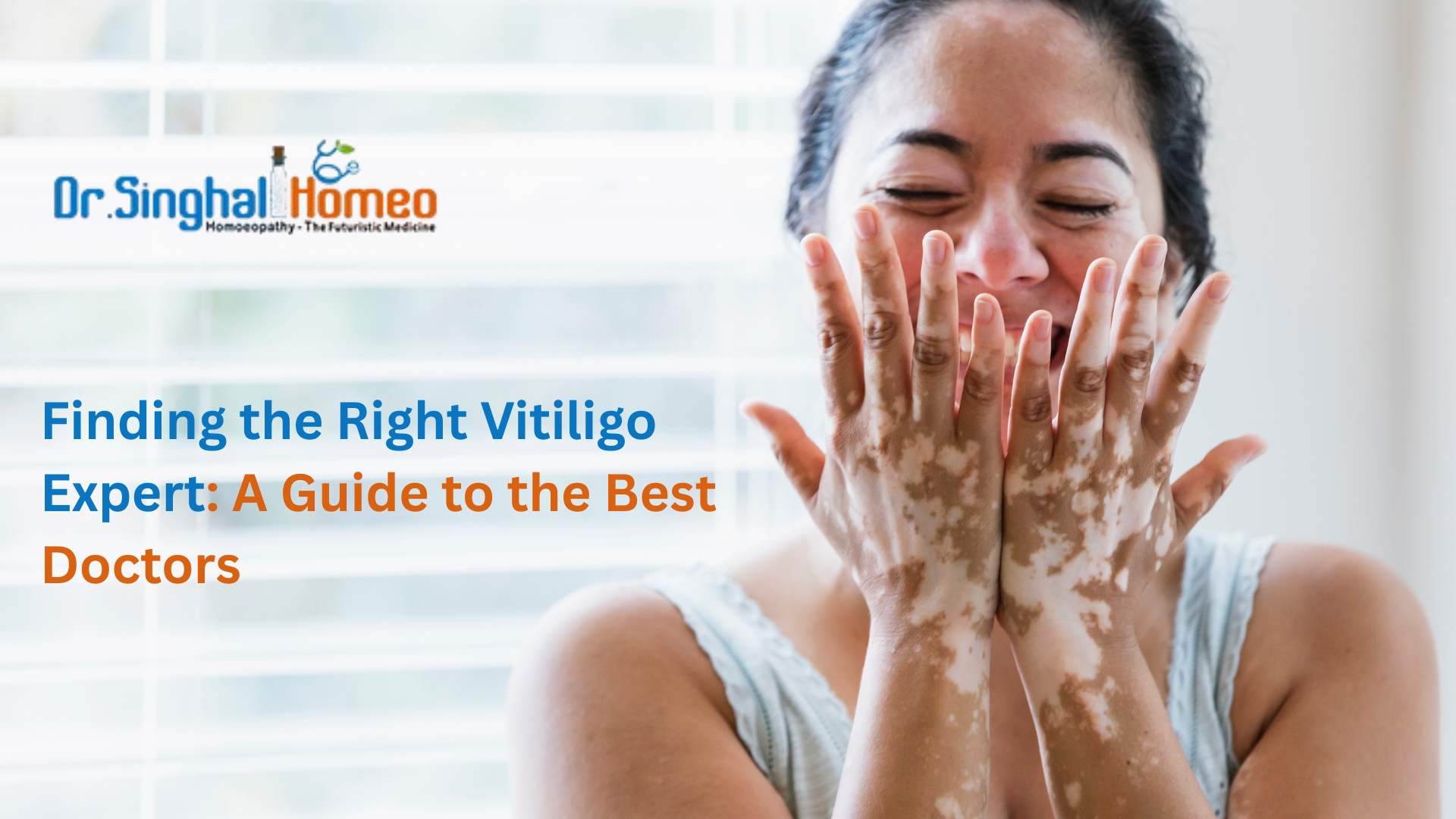 Vitiligo: Effective Treatment Options and How to Find the Best Doctor – health