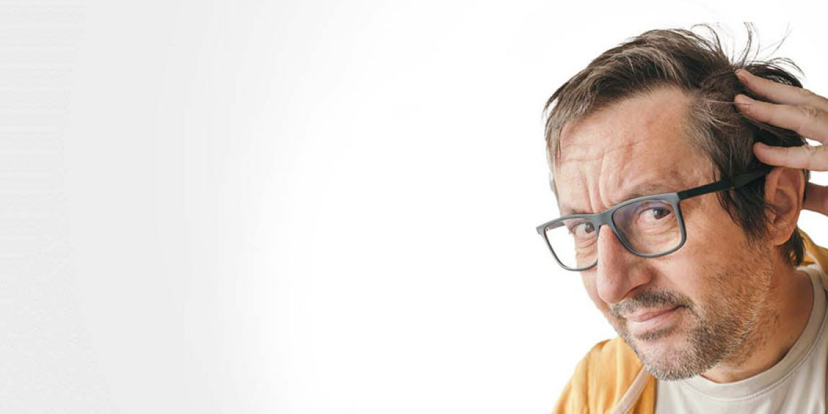 10 Factors to Consider Before Choosing a FUT Hair Transplant
